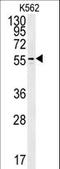 Polyamine Oxidase antibody, LS-B12847, Lifespan Biosciences, Western Blot image 