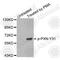 Paxillin antibody, AP0206, ABclonal Technology, Western Blot image 
