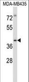 Interleukin 1 Receptor Associated Kinase 4 antibody, LS-C164429, Lifespan Biosciences, Western Blot image 