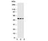 Serpin Family A Member 4 antibody, R30721, NSJ Bioreagents, Western Blot image 
