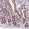 Transcription factor A, mitochondrial antibody, HPA040648, Atlas Antibodies, Immunohistochemistry paraffin image 