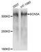 Sodium Voltage-Gated Channel Alpha Subunit 3 antibody, abx135990, Abbexa, Western Blot image 