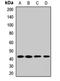 Bradykinin Receptor B2 antibody, orb412137, Biorbyt, Western Blot image 