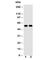 Transforming Growth Factor Beta Receptor 1 antibody, R30821, NSJ Bioreagents, Western Blot image 