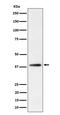Farnesyl Diphosphate Synthase antibody, M01782, Boster Biological Technology, Western Blot image 
