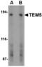 Adhesion G Protein-Coupled Receptor A2 antibody, A09540, Boster Biological Technology, Western Blot image 