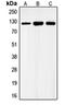 Gamma-Aminobutyric Acid Type B Receptor Subunit 1 antibody, orb213960, Biorbyt, Western Blot image 