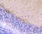 Casein Kinase 2 Beta antibody, NBP2-75431, Novus Biologicals, Immunohistochemistry paraffin image 