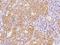 SDC1 antibody, 11429-R160, Sino Biological, Immunohistochemistry frozen image 