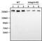 Fibronectin 1 antibody, MA5-11981, Invitrogen Antibodies, Western Blot image 