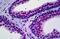 Protein Kinase, DNA-Activated, Catalytic Subunit antibody, MBS245753, MyBioSource, Immunohistochemistry paraffin image 