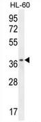 Zinc finger protein 322B antibody, AP54690PU-N, Origene, Western Blot image 