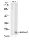 Stathmin 1 antibody, GTX50655, GeneTex, Western Blot image 