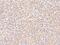 Ubiquinol-Cytochrome C Reductase Core Protein 2 antibody, 104722-T12, Sino Biological, Immunohistochemistry paraffin image 