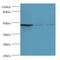 Ectonucleoside Triphosphate Diphosphohydrolase 5 (Inactive) antibody, MBS1492677, MyBioSource, Western Blot image 