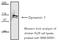 Dynamin 1 antibody, M02536, Boster Biological Technology, Western Blot image 