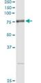 Arginyl Aminopeptidase antibody, H00006051-M02, Novus Biologicals, Immunoprecipitation image 