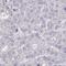 Zinc Finger Protein 736 antibody, HPA061215, Atlas Antibodies, Immunohistochemistry paraffin image 