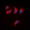ATPase Copper Transporting Beta antibody, abx121923, Abbexa, Western Blot image 