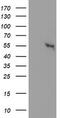 Glucosylceramidase Beta 3 (Gene/Pseudogene) antibody, CF502516, Origene, Western Blot image 