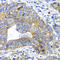 ADP Ribosylation Factor GTPase Activating Protein 1 antibody, A7118, ABclonal Technology, Immunohistochemistry paraffin image 