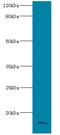 Apolipoprotein C3 antibody, MBS1488799, MyBioSource, Western Blot image 