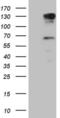 Poly(ADP-Ribose) Glycohydrolase antibody, MA5-27003, Invitrogen Antibodies, Western Blot image 