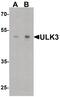 Unc-51 Like Kinase 3 antibody, PA5-38030, Invitrogen Antibodies, Western Blot image 