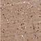 Katanin Regulatory Subunit B1 antibody, NBP1-87503, Novus Biologicals, Immunohistochemistry paraffin image 