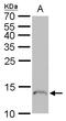 Profilin 1 antibody, GTX102072, GeneTex, Western Blot image 