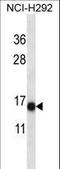 S100 Calcium Binding Protein A7 antibody, LS-C162829, Lifespan Biosciences, Western Blot image 