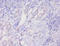 Prohibitin antibody, A52978-100, Epigentek, Immunohistochemistry paraffin image 