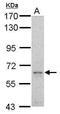 Growth Factor Receptor Bound Protein 10 antibody, GTX125980, GeneTex, Western Blot image 