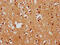 FEZ Family Zinc Finger 1 antibody, CSB-PA008602LA01HU, Cusabio, Immunohistochemistry paraffin image 