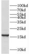 Retinol Binding Protein 7 antibody, FNab07194, FineTest, Western Blot image 