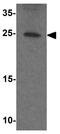 Phosducin Like 2 antibody, GTX32136, GeneTex, Western Blot image 
