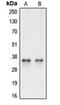 Caspase 3 antibody, orb213646, Biorbyt, Western Blot image 