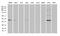 Dual Specificity Phosphatase 5 antibody, M05809, Boster Biological Technology, Western Blot image 