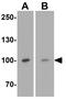 Transient Receptor Potential Cation Channel Subfamily V Member 4 antibody, GTX31567, GeneTex, Western Blot image 