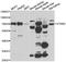 Signal Transducing Adaptor Molecule 2 antibody, orb247773, Biorbyt, Western Blot image 