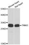 Troponin I3, Cardiac Type antibody, abx006874, Abbexa, Western Blot image 