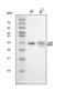 Linker For Activation Of T Cells Family Member 2 antibody, A02496-1, Boster Biological Technology, Western Blot image 