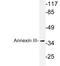 Annexin A3 antibody, LS-C291662, Lifespan Biosciences, Western Blot image 