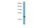 Poly(A) Binding Protein Interacting Protein 2 antibody, A07610, Boster Biological Technology, Western Blot image 