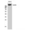 Lymphocyte Antigen 75 antibody, LS-C382532, Lifespan Biosciences, Western Blot image 