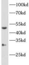 Cytochrome P450 Family 11 Subfamily B Member 2 antibody, FNab02144, FineTest, Western Blot image 
