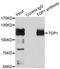 DNA Topoisomerase I antibody, STJ114398, St John