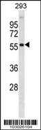 PKB beta antibody, 62-605, ProSci, Western Blot image 