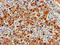 Liver-type arginase antibody, CSB-PA002005DA01HU, Cusabio, Immunohistochemistry paraffin image 