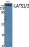 Large Tumor Suppressor Kinase 1 antibody, A01051-3, Boster Biological Technology, Western Blot image 